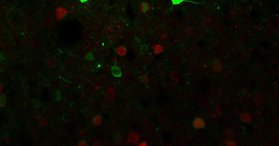 Ketamine And Obesity